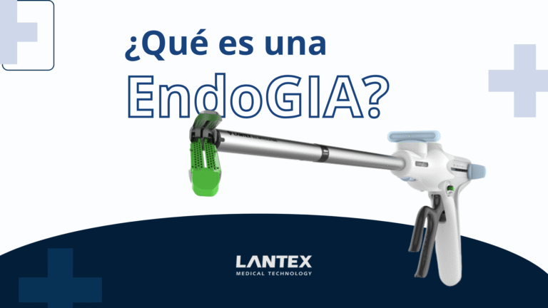 ¿Qué es una EndoGIA?